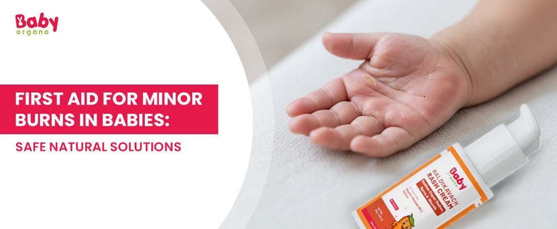 First Aid for Minor Burns in Babies: Safe Natural Solutions
