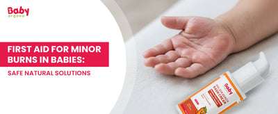 Baby’s hand with minor burn being treated using BabyOrgano Haldikavach rash cream – safe natural first aid solution for babies’ delicate skin.