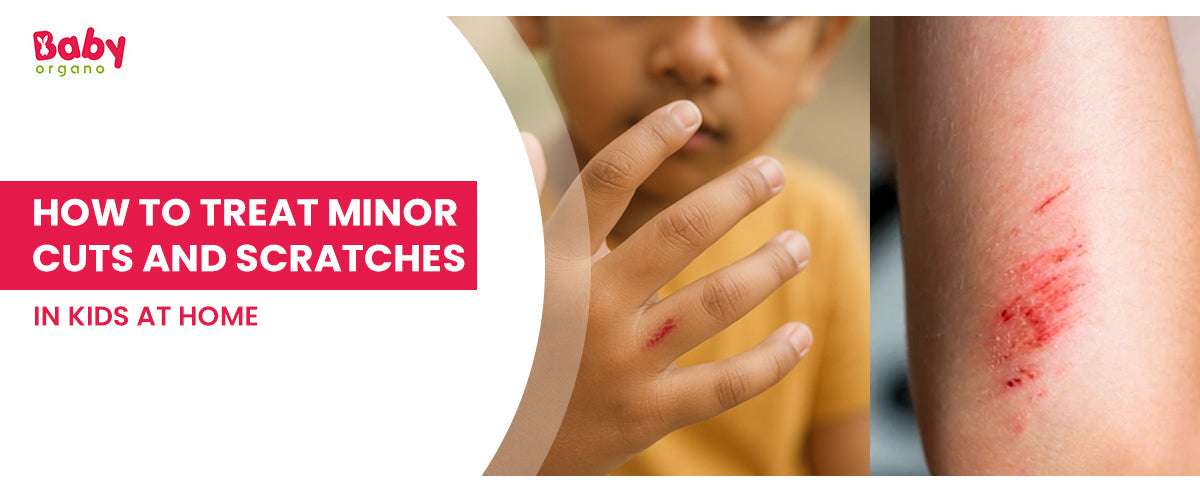 How to Treat Minor Cuts and Scratches in Kids at Home