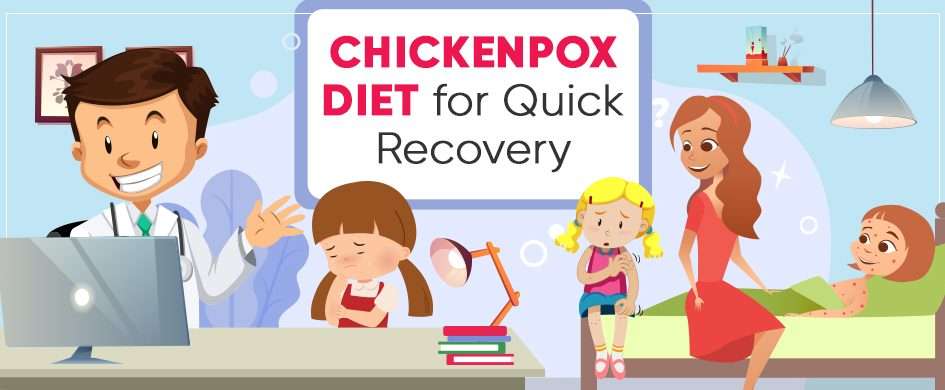 Got Chickenpox? Foods For Quick Recovery