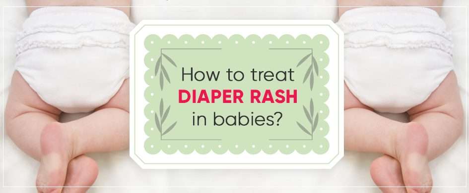 How to treat diaper rash in babies?
