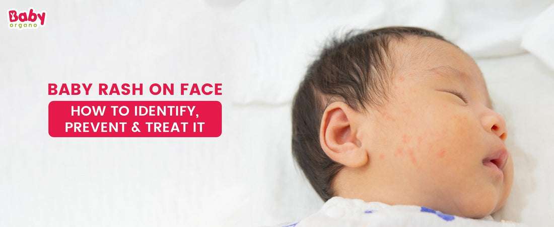 Baby Rash on Face – How to Identify, Prevent & Treat It