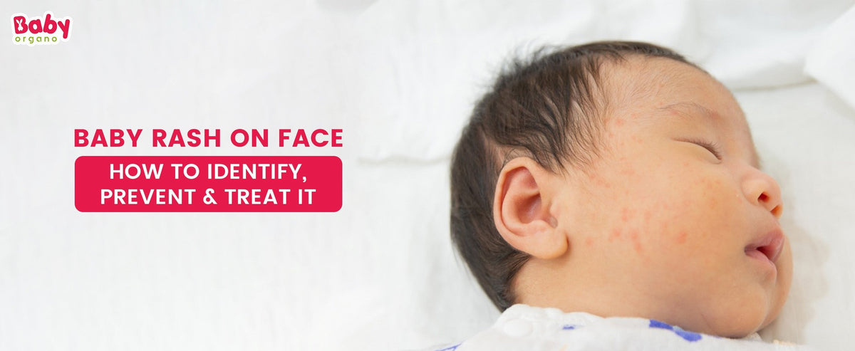 Baby Rash on Face – How to Identify, Prevent & Treat It.