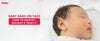 Baby Rash on Face – How to Identify, Prevent & Treat It.