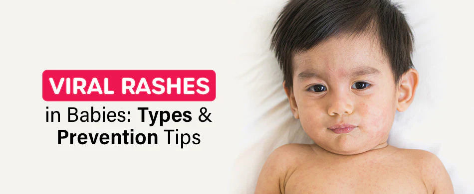 Baby with viral skin rash showing types and prevention methods – pediatric and Ayurvedic care tips