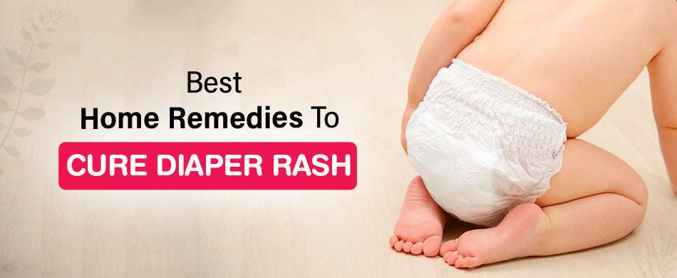Best Home Remedies To Cure Diaper Rash