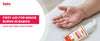 Baby’s hand with minor burn being treated using BabyOrgano Haldikavach rash cream – safe natural first aid solution for babies’ delicate skin.
