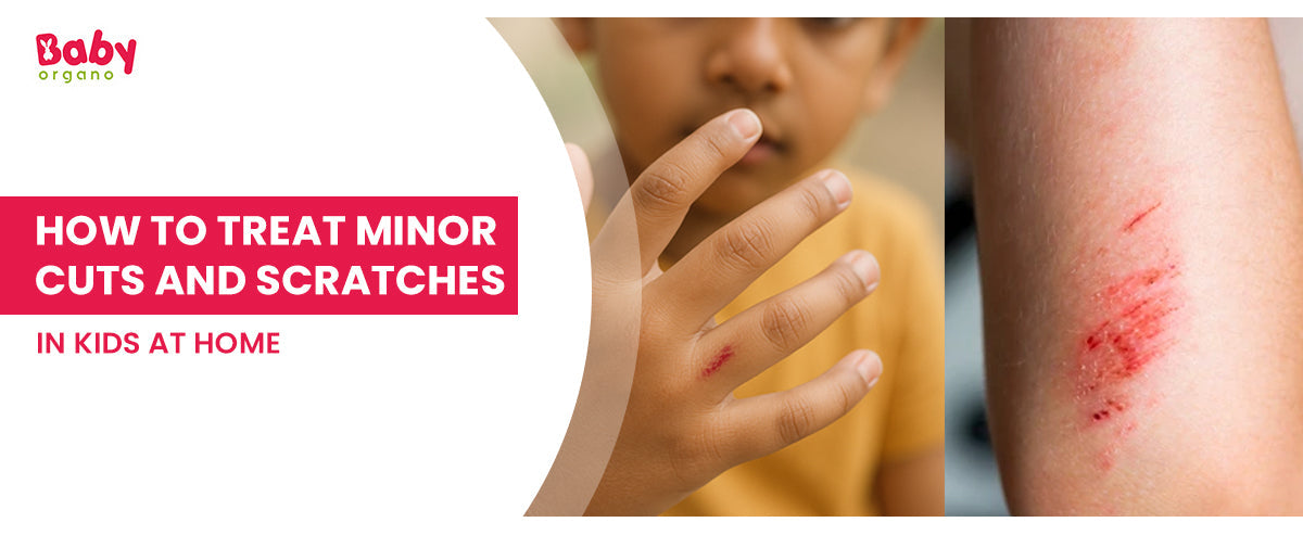 How to Treat Minor Cuts and Scratches in Kids at Home